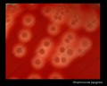 streptococcus pyogenes